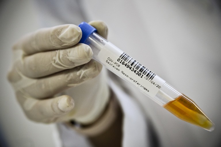 RN chega a 88.064 casos confirmados e 2.665 mortes por Covid-19