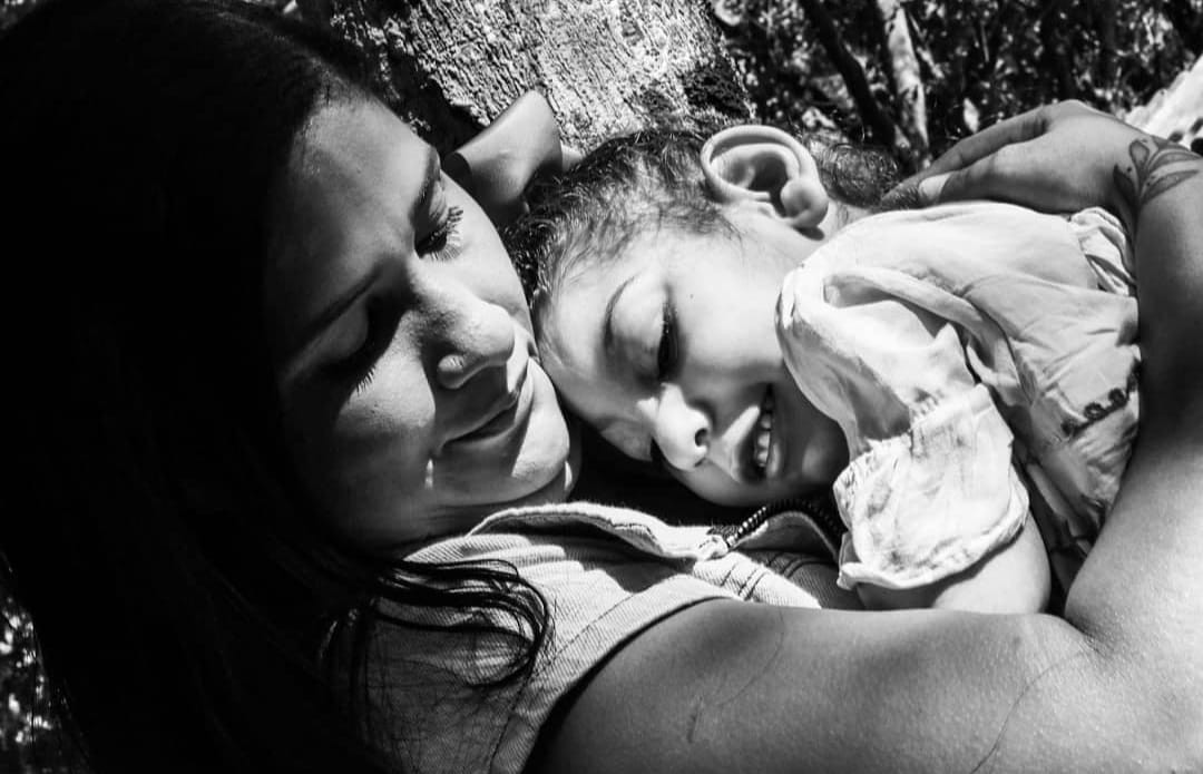 Pesquisa sugere que microcefalia por zika na Paraíba começou em 2014