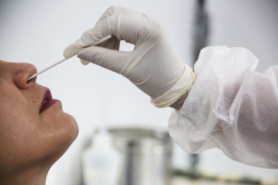 RN tem 28,5 mil testes para Covid-19 que vencem até o fim de dezembro, diz Sesap