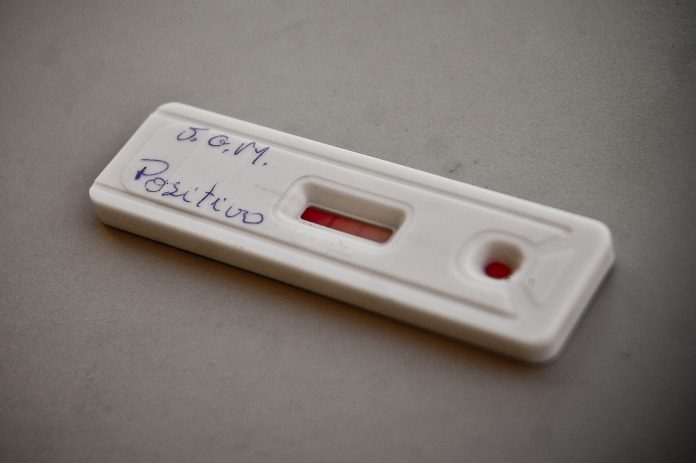 RN tem 114.799 casos confirmados e 2.933 mortes por Covid-19