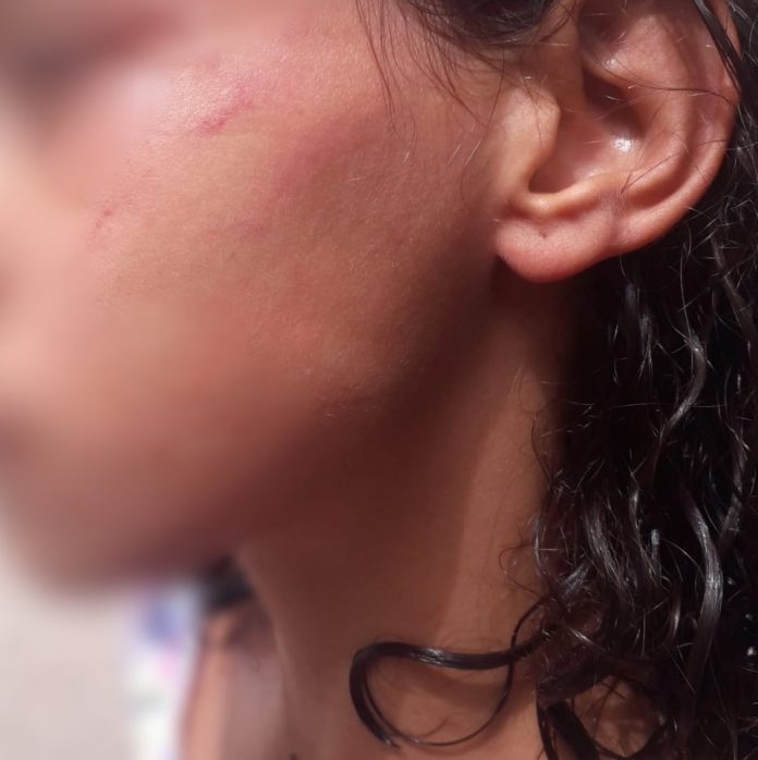 Adolescente é agredida com tapas no rosto por Policial Militar de folga, na Paraíba