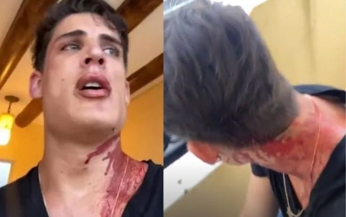 Ex-padrasto de Neymar, Tiago Ramos se revolta após levar facada no México