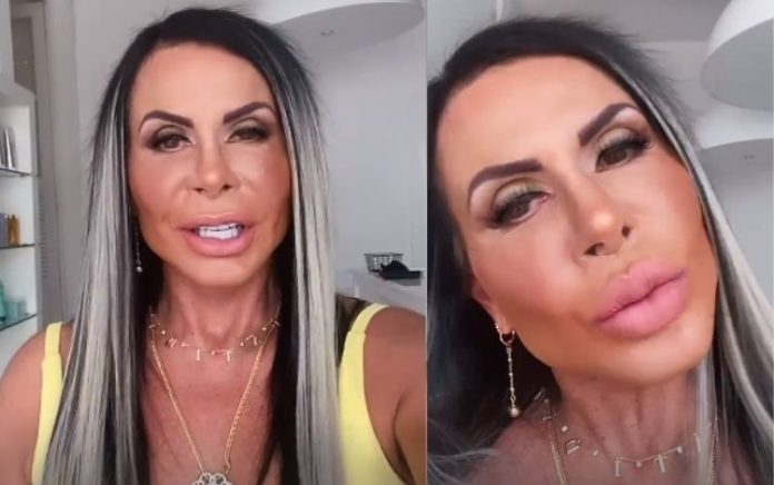 Gretchen rebate críticas e mostra resultado de harmonização: ‘Lindinha’