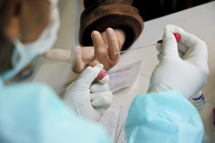 RN registra pela primeira vez mais de 1 mil casos de Covid-19 por três dias seguidos