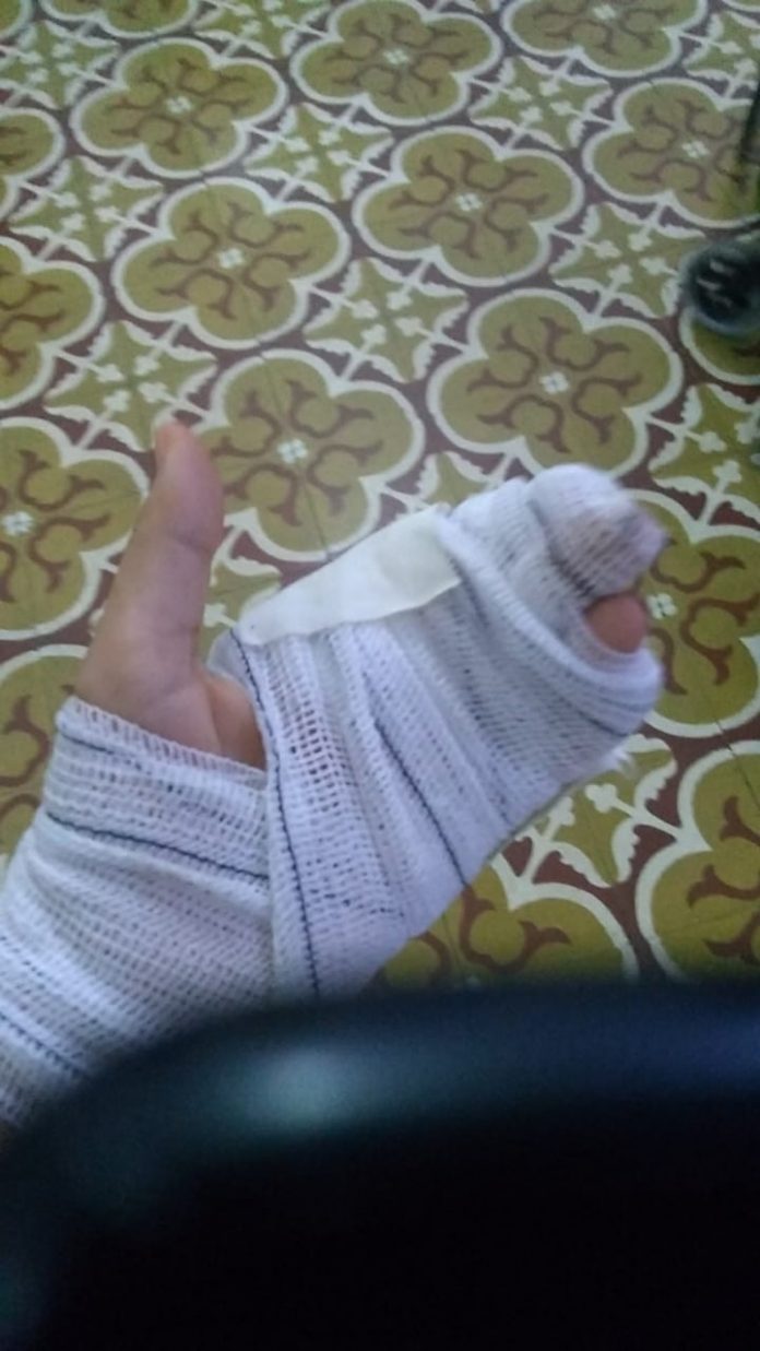 Criminosos cortam dedo de mulher com foice durante arrastão em casa no interior do RN