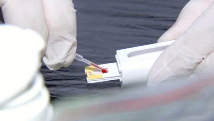 Rio Grande do Norte tem 138.812 casos confirmados e 3.276 mortes por Covid-19