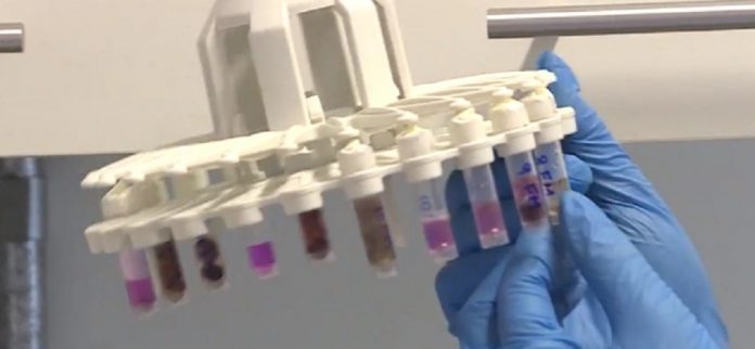 RN tem 124.523 casos confirmados e 3.098 mortes por Covid-19