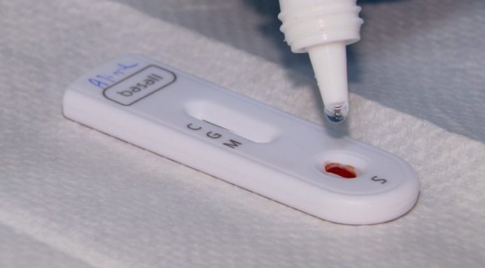 RN registra 141.21 casos confirmados e 3.300 mortes por Covid-19