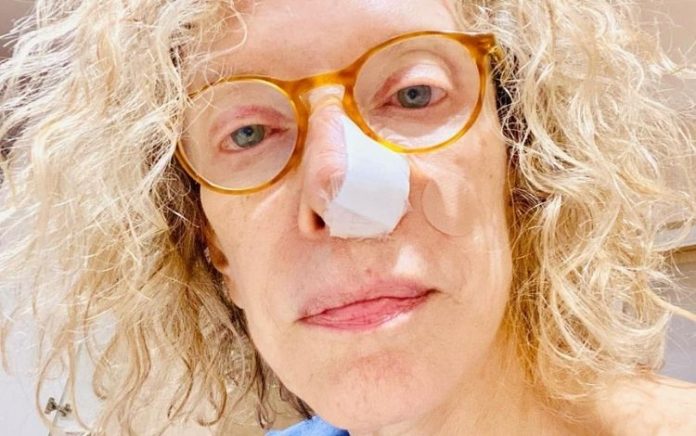 Marília Gabriela passar por cirurgia após descobrir câncer de pele: ‘Estressante’