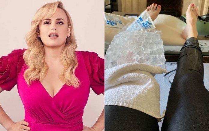 Rebel Wilson, de ‘A Escolha Perfeita’, sofre acidente de bicicleta ao fugir de cachorros