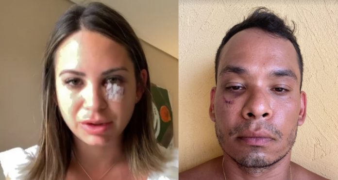 Médico diz que está com ‘emocional destruído’ após briga em resort na Bahia; grupo acusa empresário de agressões