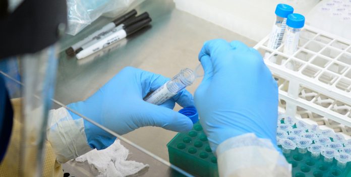 RN tem 177.127 casos confirmados e 3.806 mortes por Covid-19