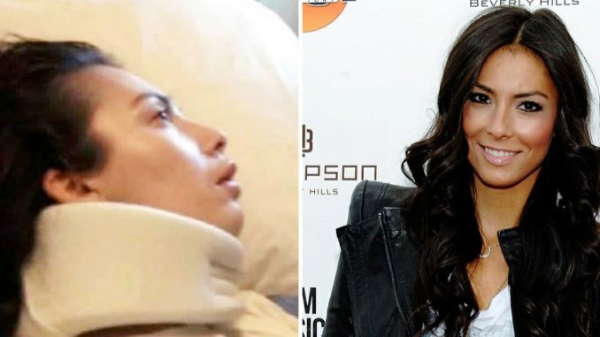 Atriz recebe R$ 168 milhões por dano cerebral após comer pretzel nos EUA