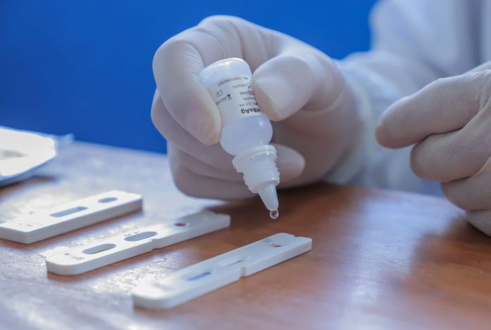 João Pessoa tem mutirão de testagem para Covid-19 em dois pontos, nesta terça (18)