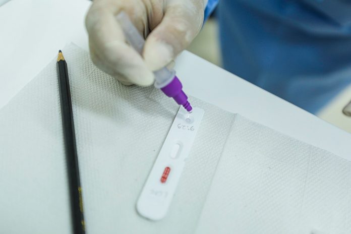 João Pessoa realiza testagem de Covid-19 em oito locais da cidade