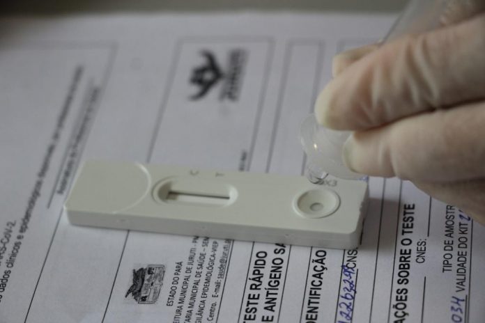 Testagem em servidores da Câmara Municipal de João Pessoa tem mais de 20% de positivo para Covid-19