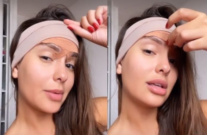 Thais Braz tira curativos e mostra testa pela primeira vez após cirurgia; veja