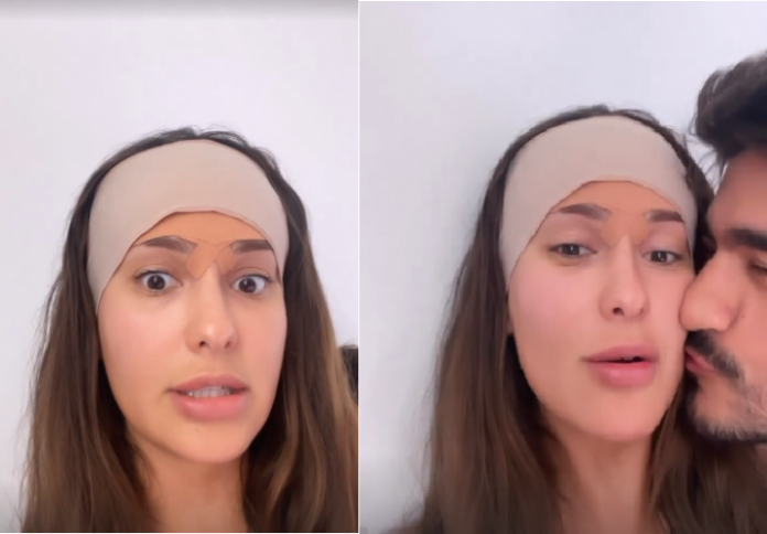 Ex-BBB Thais Braz faz cirurgia para redução da testa; veja foto