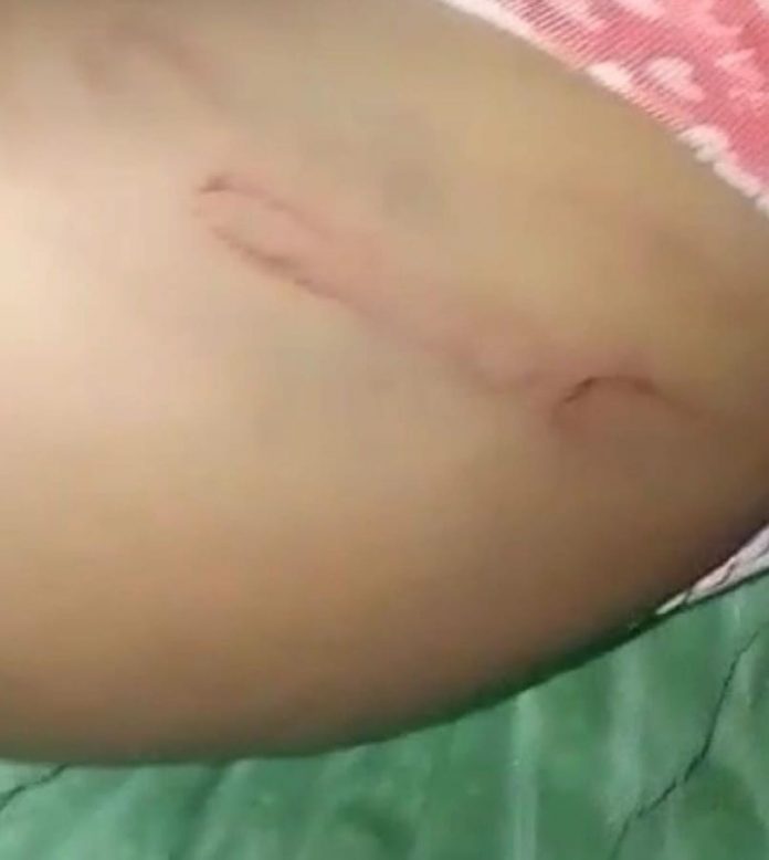 Mãe é presa suspeita de espancar criança de cinco anos, em Cabedelo