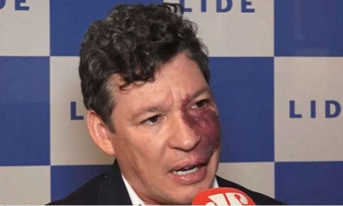 Deputados avaliam impacto da inclusão da carne na cesta básica desonerada