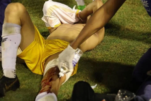 VÍDEO: Goleiro dentro de campo leva tiro na perna disparado por PM