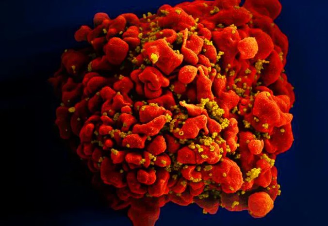 Medicamento apresenta eficácia de 100% na prevenção contra o HIV