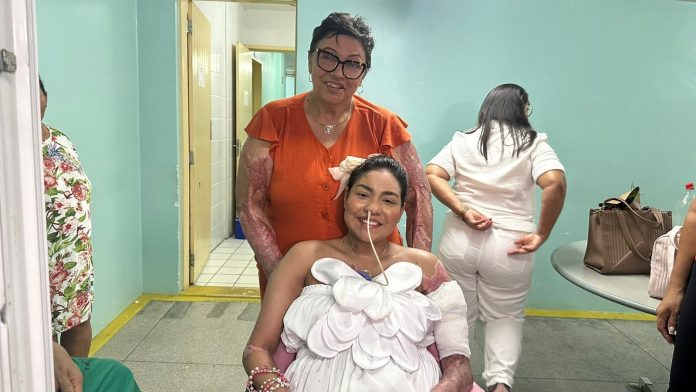 Após um ano, vítima de explosão de carro durante abastecimento de combustível tem alta de hospital